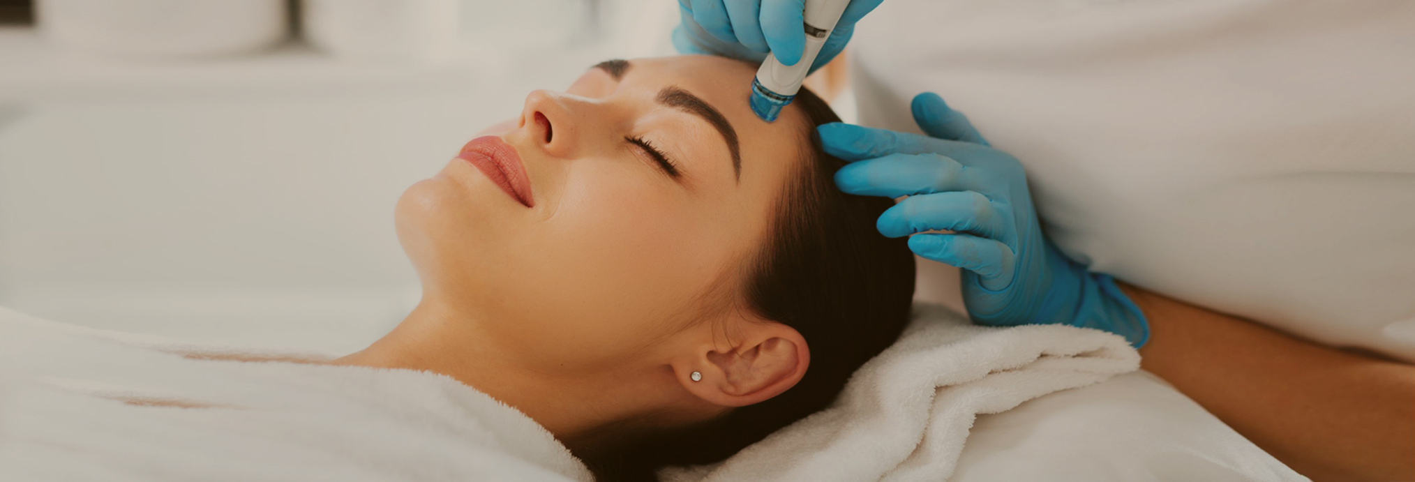 Microneedling